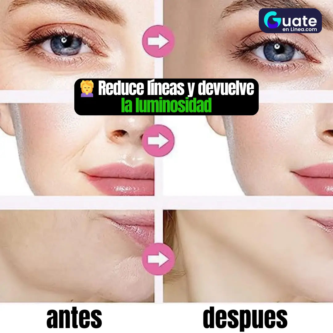 Dispositivo de Rejuvenecimiento Facial