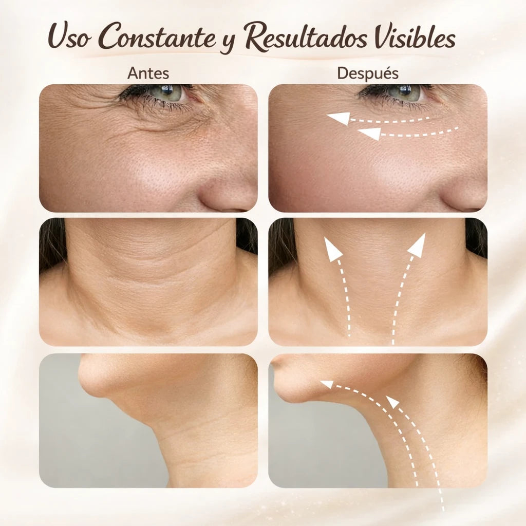 ✨ Mejora la apariencia de papada y contorno mandibular 💎